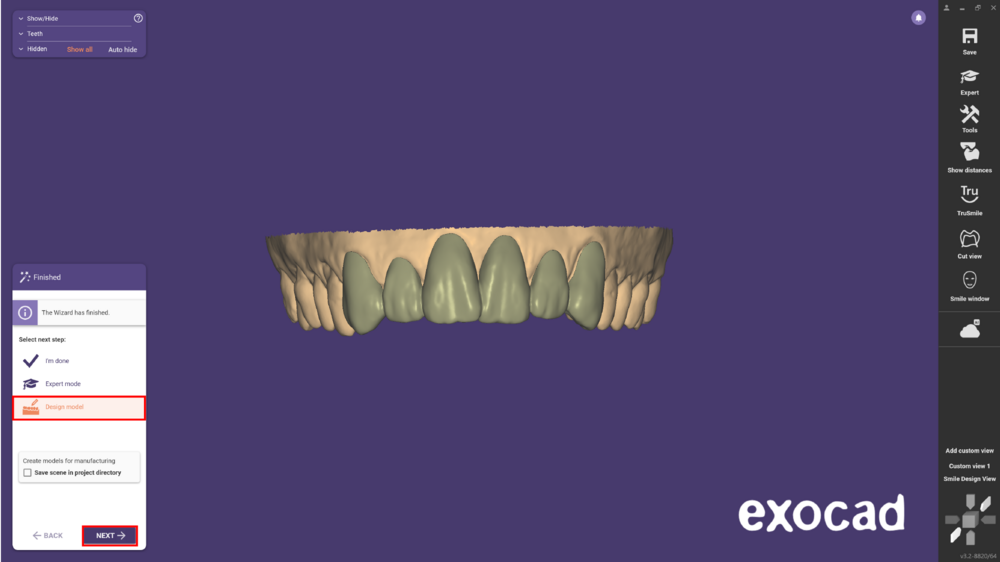 مدل موکاپ mockup model در اگزوکد - شبیهسازی Waxup یا طراحی لبخند دیجیتال 3 مدل موکاپ mockup model در اگزوکد - شبیهسازی Waxup یا طراحی لبخند دیجیتال