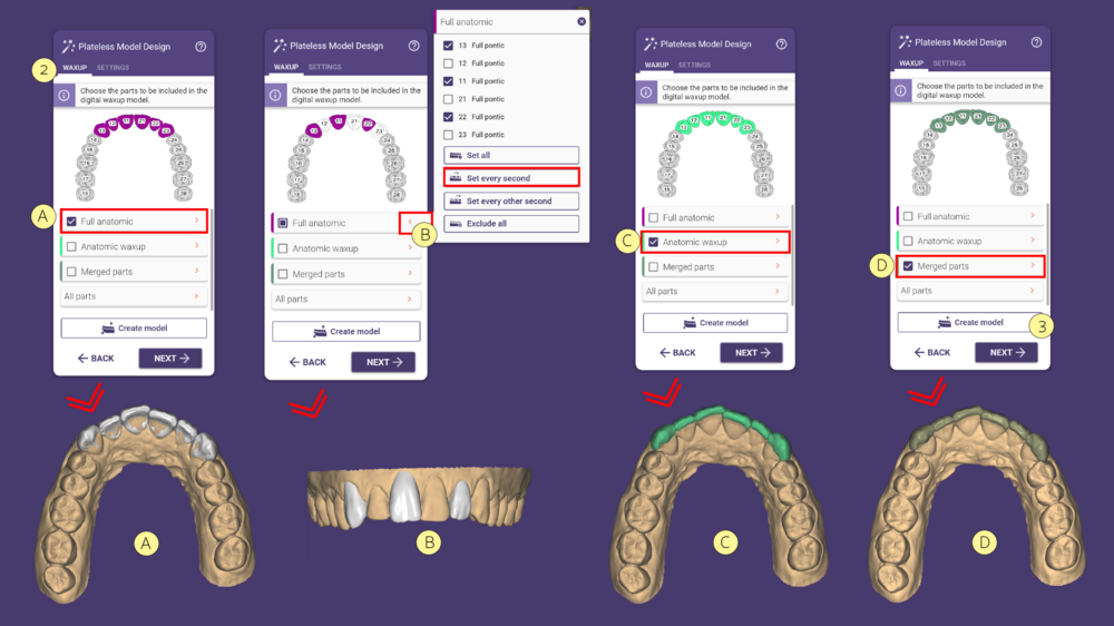 مدل موکاپ mockup model در اگزوکد - شبیهسازی Waxup یا طراحی لبخند دیجیتال 5 مدل موکاپ mockup model در اگزوکد - شبیهسازی Waxup یا طراحی لبخند دیجیتال