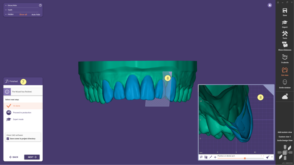 مدل موکاپ mockup model در اگزوکد - شبیهسازی Waxup یا طراحی لبخند دیجیتال 8 مدل موکاپ در اگزوکد: شبیهسازی Waxup یا طراحی لبخند دیجیتال