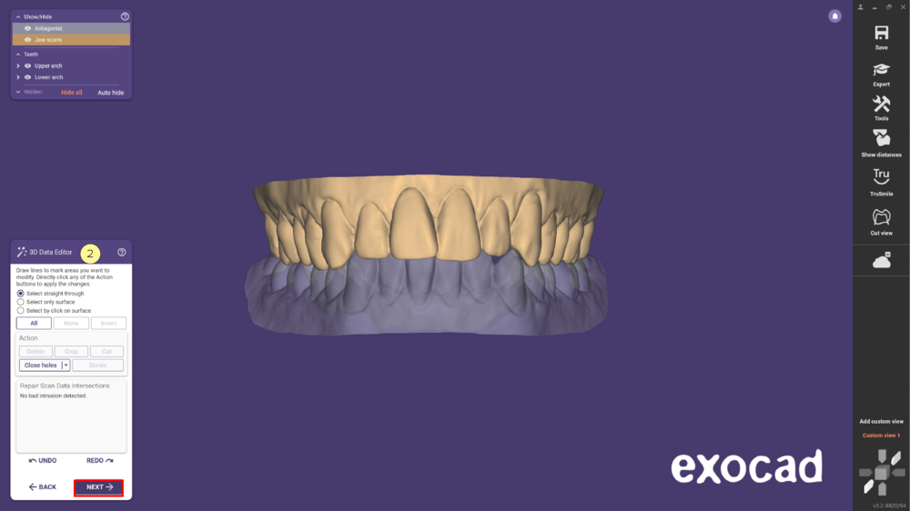 مدل موکاپ mockup model در اگزوکد - شبیهسازی Waxup یا طراحی لبخند دیجیتال 12 مدل موکاپ در اگزوکد - شبیهسازی Waxup یا طراحی لبخند دیجیتال
