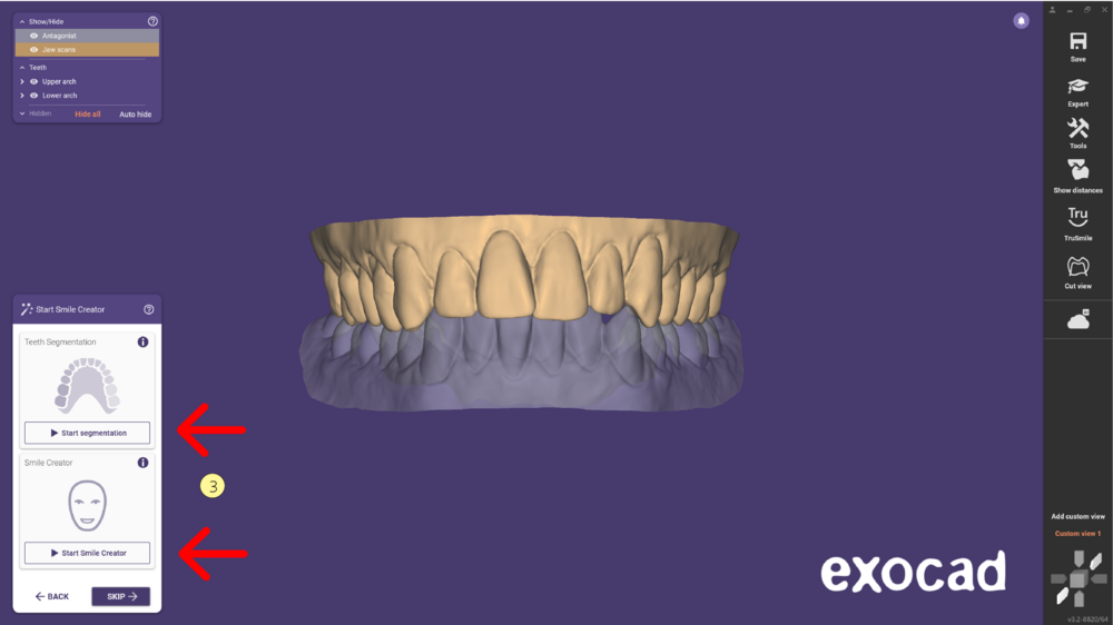 مدل موکاپ mockup model در اگزوکد - شبیهسازی Waxup یا طراحی لبخند دیجیتال 13 مدل موکاپ در اگزوکد - شبیهسازی Waxup یا طراحی لبخند دیجیتال