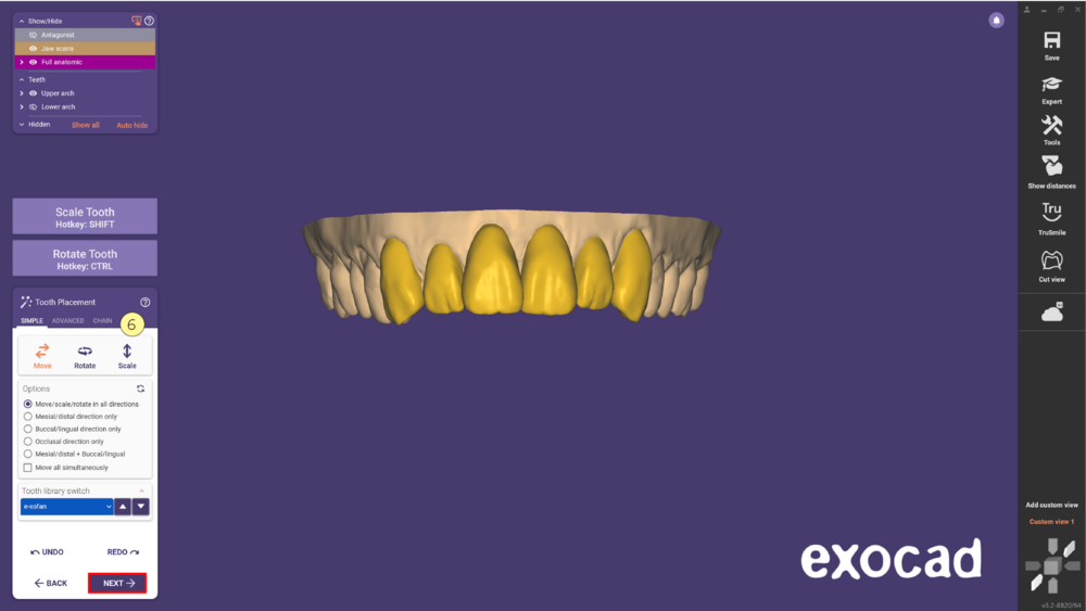 مدل موکاپ mockup model در اگزوکد - شبیهسازی Waxup یا طراحی لبخند دیجیتال 15 مدل موکاپ در اگزوکد - شبیهسازی Waxup یا طراحی لبخند دیجیتال