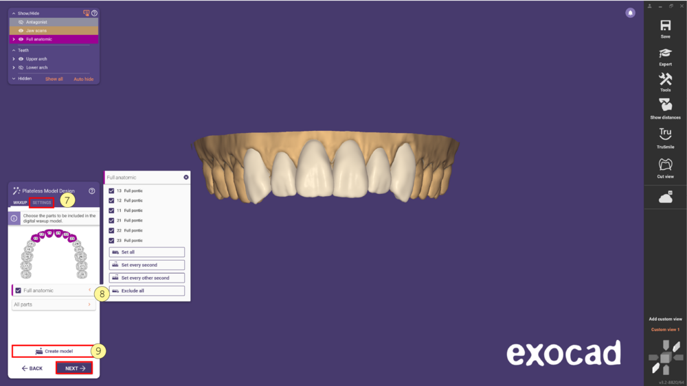 مدل موکاپ mockup model در اگزوکد - شبیهسازی Waxup یا طراحی لبخند دیجیتال 16 مدل موکاپ در اگزوکد - شبیهسازی Waxup یا طراحی لبخند دیجیتال
