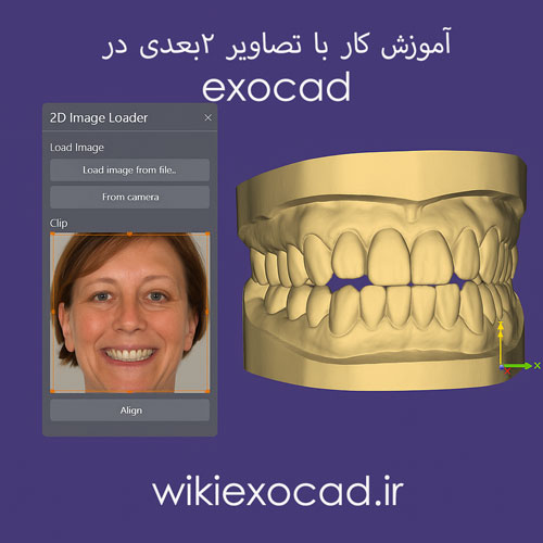 آموزش کار با تصاویر ۲بعدی (Working with 2D images) در اگزوکد – بارگذاری، تراز و برش عکس بیمار 1 آموزش کار با تصاویر ۲بعدی در exocad