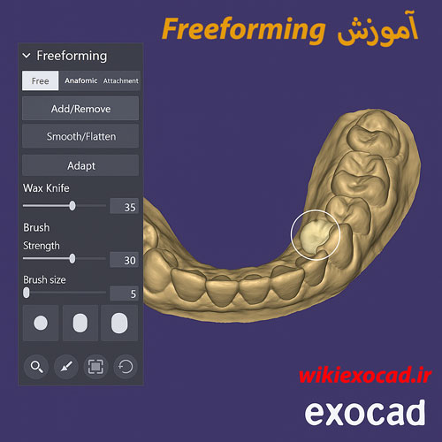 آموزش Freeforming در exocad – تغییر شکل آناتومیک دندان با ابزار Free-Forming در اگزوکد 1 آموزش Freeforming