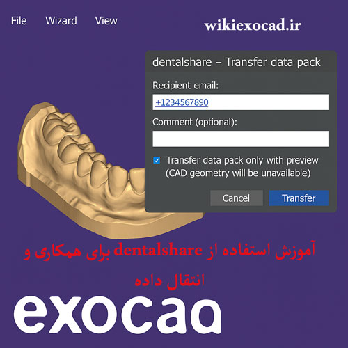 آموزش استفاده از Using dentalshare for collaboration and data transfer برای همکاری و انتقال داده در اگزوکد 1 آموزش استفاده از dentalshare برای همکاری و انتقال داده در exocad