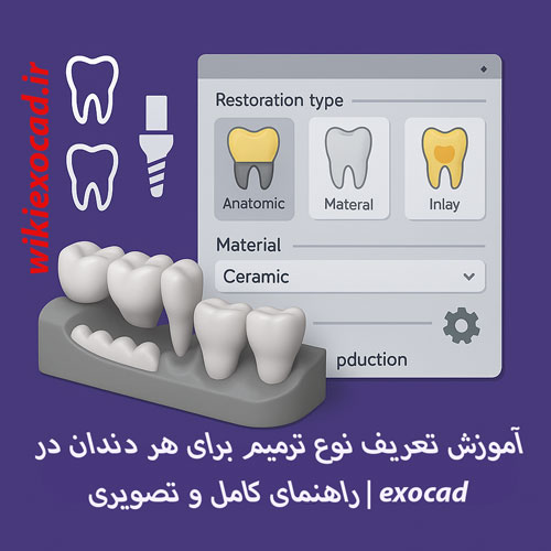آموزش تعریف نوع ترمیم برای هر دندان Defining jobs for individual teeth در اگزوکد | راهنمای کامل و تصویری 1 آموزش تعریف نوع ترمیم برای هر دندان در exocad | راهنمای کامل و تصویری