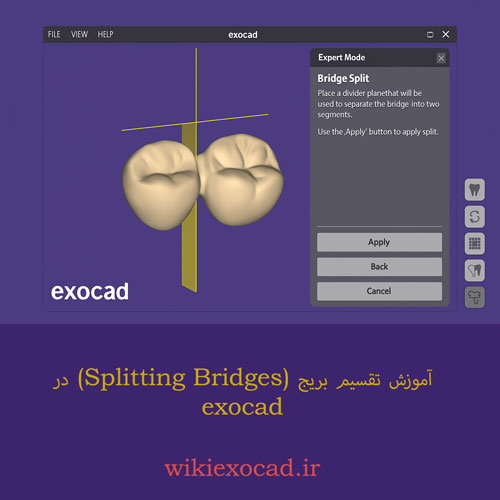 آموزش تقسیم بریج (Splitting Bridges) در اگزوکد – راهکار تقسیم دندانها برای فیت بهتر 1 آموزش تقسیم بریج (Splitting Bridges) در exocad