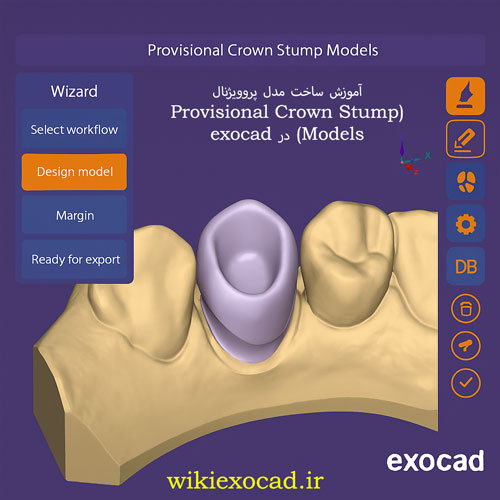 آموزش ساخت مدل پروویژنال (Provisional Crown Stump Models) در اگزوکد 7 آموزش ساخت مدل پروویژنال (Provisional Crown Stump Models) در exocad