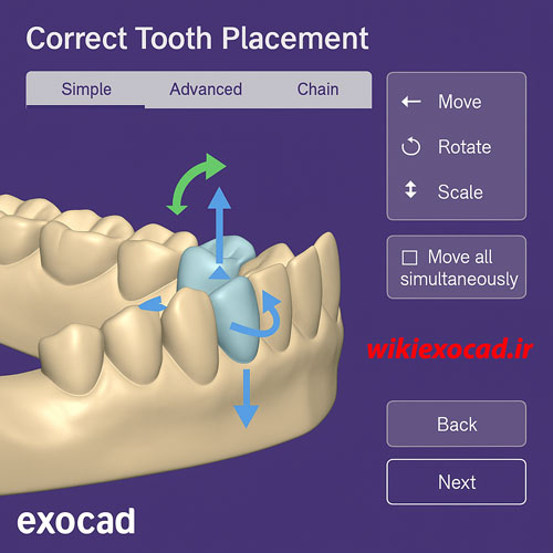 آموزش قرارگیری صحیح دندان (Tooth Placement) در exocad – گامبهگام با حالتهای Simple، Advanced و Chain در اگزوکد 1 آموزش قرارگیری صحیح دندان (Tooth Placement) در exocad