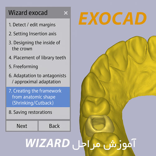 آموزش مراحل Wizard در exocad – گامبهگام طراحی پروتز و روکش در اگزوکد 1 آموزش مراحل Wizard در exocad