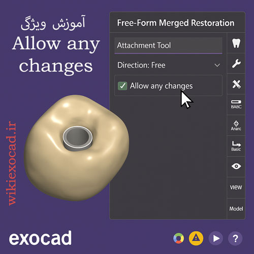 آموزش ویژگی Allow any changes در اگزوکد – تغییر آزادانه مش در Free-Form Merged Restoration 1 آموزش ویژگی Allow any changes در exocad