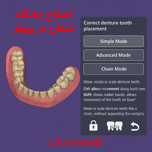 اصلاح جایگاه دندان در پروتز (Correct Denture Tooth Placement) در اگزوکد 1 اصلاح جایگاه دندان در پروتز