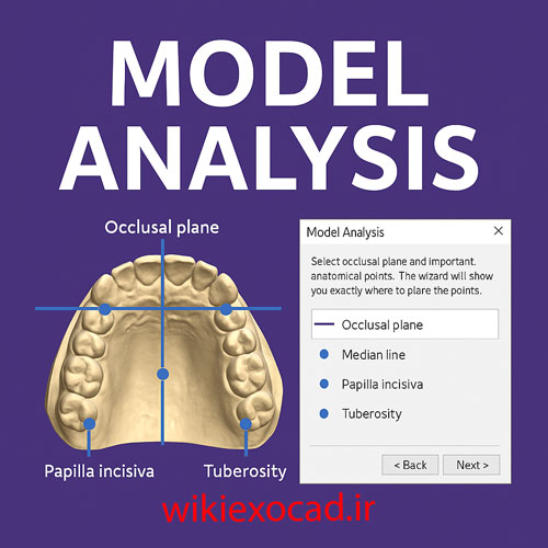 تحلیل مدل (Model Analysis) در اگزوکد – تعیین سطح اکلوژال و نقاط آناتومیک 1 تحلیل مدل (Model Analysis) در exocad – تعیین سطح اکلوژال و نقاط آناتومیک
