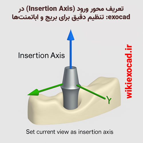 تعریف محور ورود (Insertion Axis) در اگزوکد - تنظیم دقیق برای بریج و اباتمنتها 1 تعریف محور ورود (Insertion Axis) در exocad تنظیم دقیق برای بریج و اباتمنتها