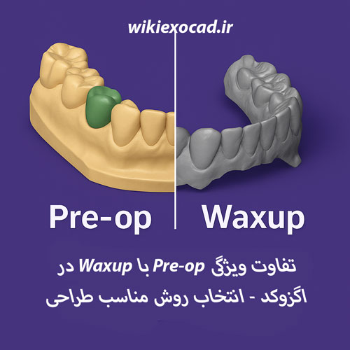 تفاوت ویژگی Pre‑op با Waxup در اگزوکد - انتخاب روش مناسب طراحی 1 تفاوت ویژگی Pre‑op با Waxup در اگزوکد: انتخاب روش مناسب طراحی
