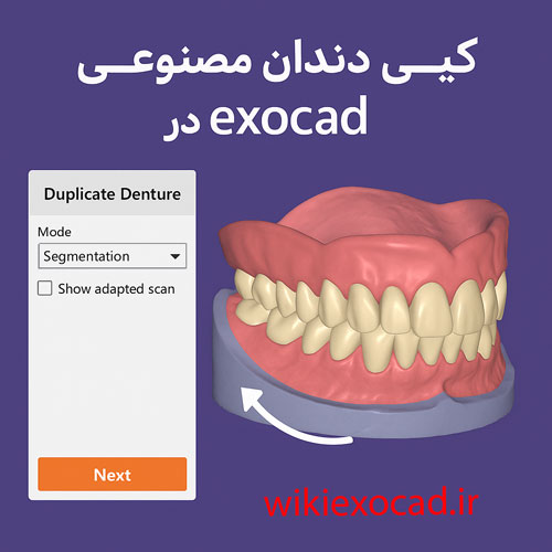 ساخت مجدد دست دندان از نمونه قبلی (Duplicate denture) در اگزوکد - بازتولید سریع و هوشمندانه 1 ساخت مجدد دست دندان از نمونه قبلی (Duplicate denture) در اگزوکد - بازتولید سریع و هوشمندانه