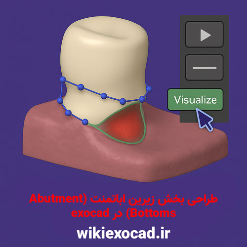 طراحی بخش زیرین اباتمنت (Abutment Bottoms) در اگزوکد 17 طراحی بخش زیرین اباتمنت (Abutment Bottoms) در exocad