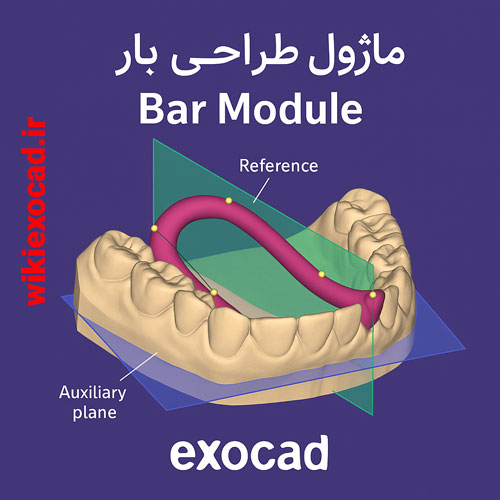 ماژول طراحی بار (Bar Module) در exocad | طراحی حرفه‌ای بارهای دندانی در اگزوکد