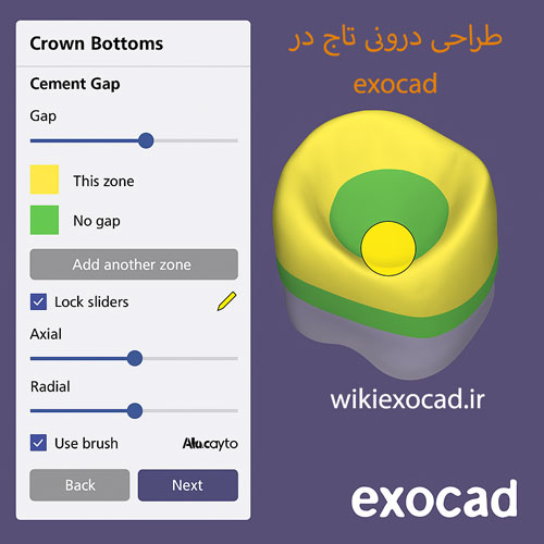طراحی سطح داخلی روکش Designing the inside of the crown در اگزوکد 1 طراحی درونی تاج در exocad