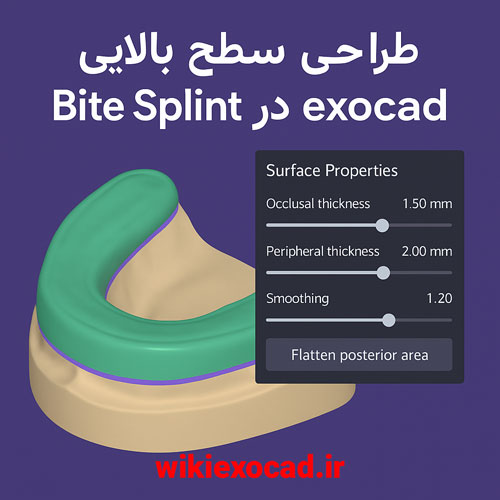 طراحی آزاد سطح بالایی بایت اسپلینت (Design bite splint bottom: Freeforming) در اگزوکد 1 طراحی سطح بالایی Bite Splint در exocad