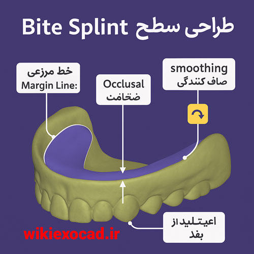 طراحی سطح بالایی بایت اسپلینت (Design the bitesplint top) در نرم افزار اگزوکد 1 طراحی سطح بالایی بایت اسپلینت (Design the bitesplint top) در نرم افزار اگزوکد