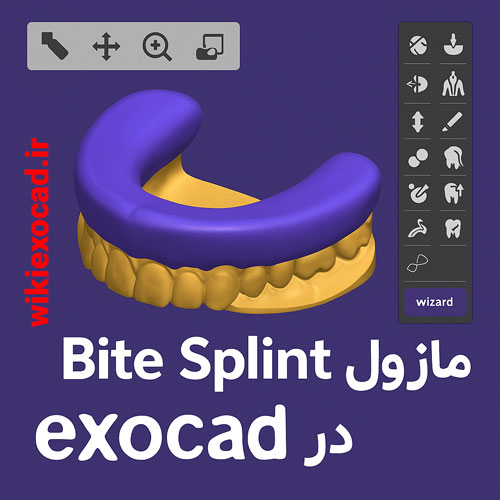 ماژول Bite Splint در اگزوکد | طراحی و ساخت اسپلینت دندانی دیجیتال 1 ماژول Bite Splint در exocad | طراحی و ساخت اسپلینت دندانی دیجیتال در اگزوکد