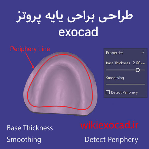 طراحی پایه پروتز (Designing the denture base) در اگزوکد – آموزش کامل 1 طراحی پایه پروتز (Denture Base) در exocad – آموزش کامل