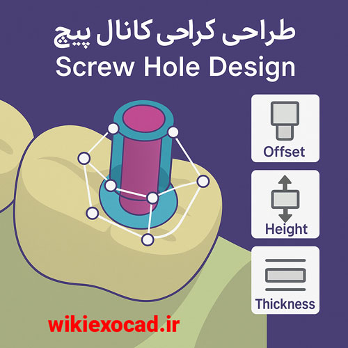 طراحی کانال پیچ Screw Hole Design در اگزوکد 1 طراحی کانال پیچ exocad