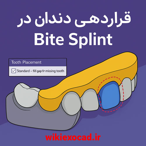 بایت اسپلینت: جایگذاری دندانها (Bite Splint: Tooth Placement) در اگزوکد 1 قراردهی دندان در Bite Splint exocad