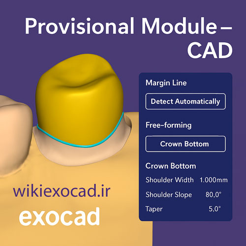 ماژول روکش موقت (Provisional Module – CAD) در اگزوکد 1 ماژول روکش موقت (Provisional Module – CAD) در exocad