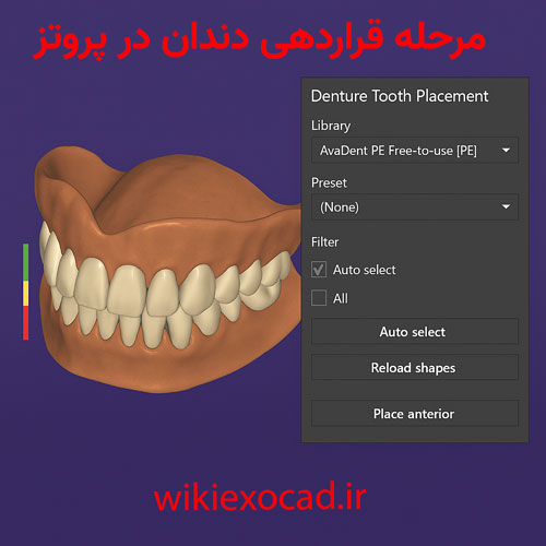 مرحله قراردهی دندان در پروتز (Denture Tooth Placement) در اگزوکد 1 مرحله قراردهی دندان در پروتز (Denture Tooth Placement) در exocad
