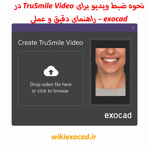 نحوه ضبط ویدیو برای TruSmile Video در اگزوکد – راهنمای دقیق و عملی 1 نحوه ضبط ویدیو برای TruSmile Video در exocad – راهنمای دقیق و عملی