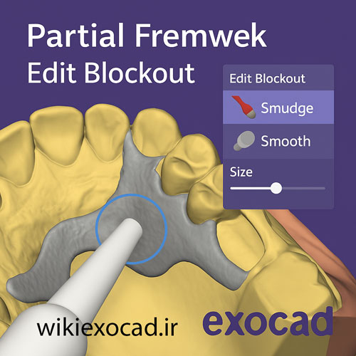 آموزش ویرایش بلوک‌اوت Blockout در فُرم‌وُرک پارسیل exocad