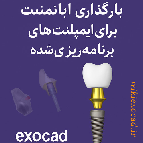 بارگذاری پشتیبانی اباتمنت برای ایمپلنت‌های برنامه‌ریزی‌شده در exocad
