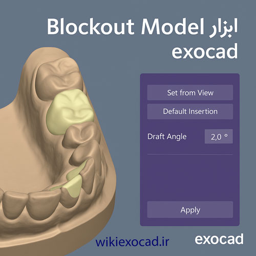 مدل بررسی زیر برش Partial Framework - Blockout model در اگزوکد – پر کردن Undercut با واکس 7 مدل بررسی زیر برش Blockout در exocad PartialCAD – پر کردن Undercut با واکس