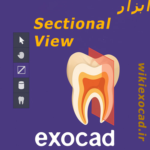 آموزش ابزار Sectional View در exocad | برش و مشاهده طراحی داخلی 1 آموزش ابزار Sectional View در exocad