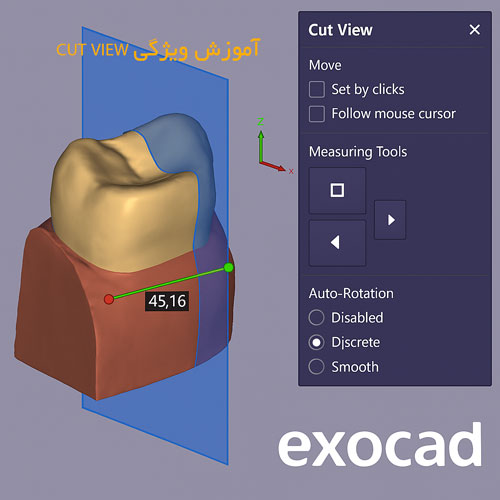 آموزش ویژگی Cut View در exocad – نماهای مقطعی و اندازهگیری دقیق در اگزوکد 1 آموزش ویژگی Cut View در exocad