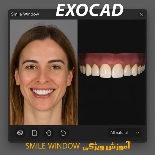 آموزش ویژگی Smile Window در exocad – پیشنمایش لبخند در حین طراحی در اگزوکد 1 آموزش ویژگی Smile Window در exocad