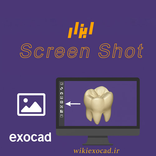 آموزش ابزار Screen Shot در exocad | راهنمای تصویری و مدیریت اسکرینشات 1 ابزار Screen Shot در exocad