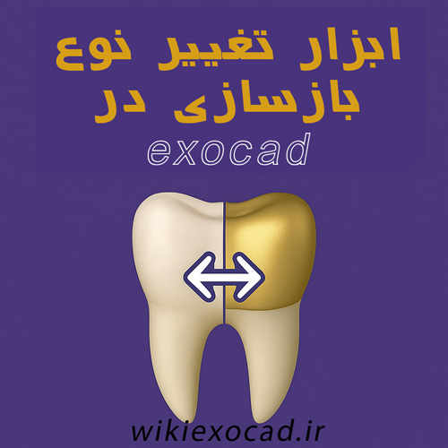 آموزش ابزار تغییر نوع بازسازی Change Reconstruction Type در اگزوکد 27 ابزار تغییر نوع بازسازی در exocad