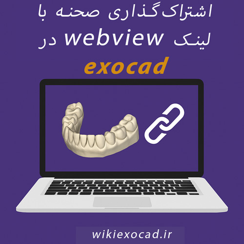 اشتراک‌گذاری صحنه با لینک webview در exocad