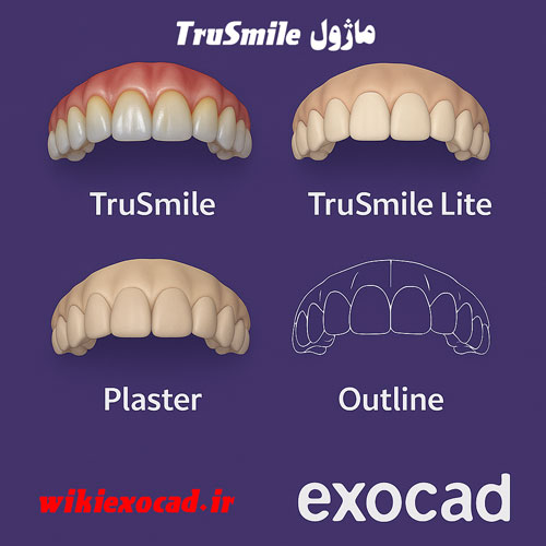 ماژول TruSmile در exocad | رندر واقعگرایانه دندان با کیفیت فوتورئال در اگزوکد 1 ماژول TruSmile در exocad